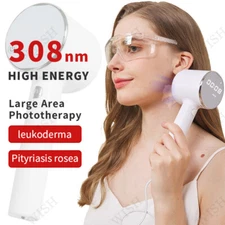 308nm UV Ultraviolet therapy device for vitiligo and pityriasis rosea treatment