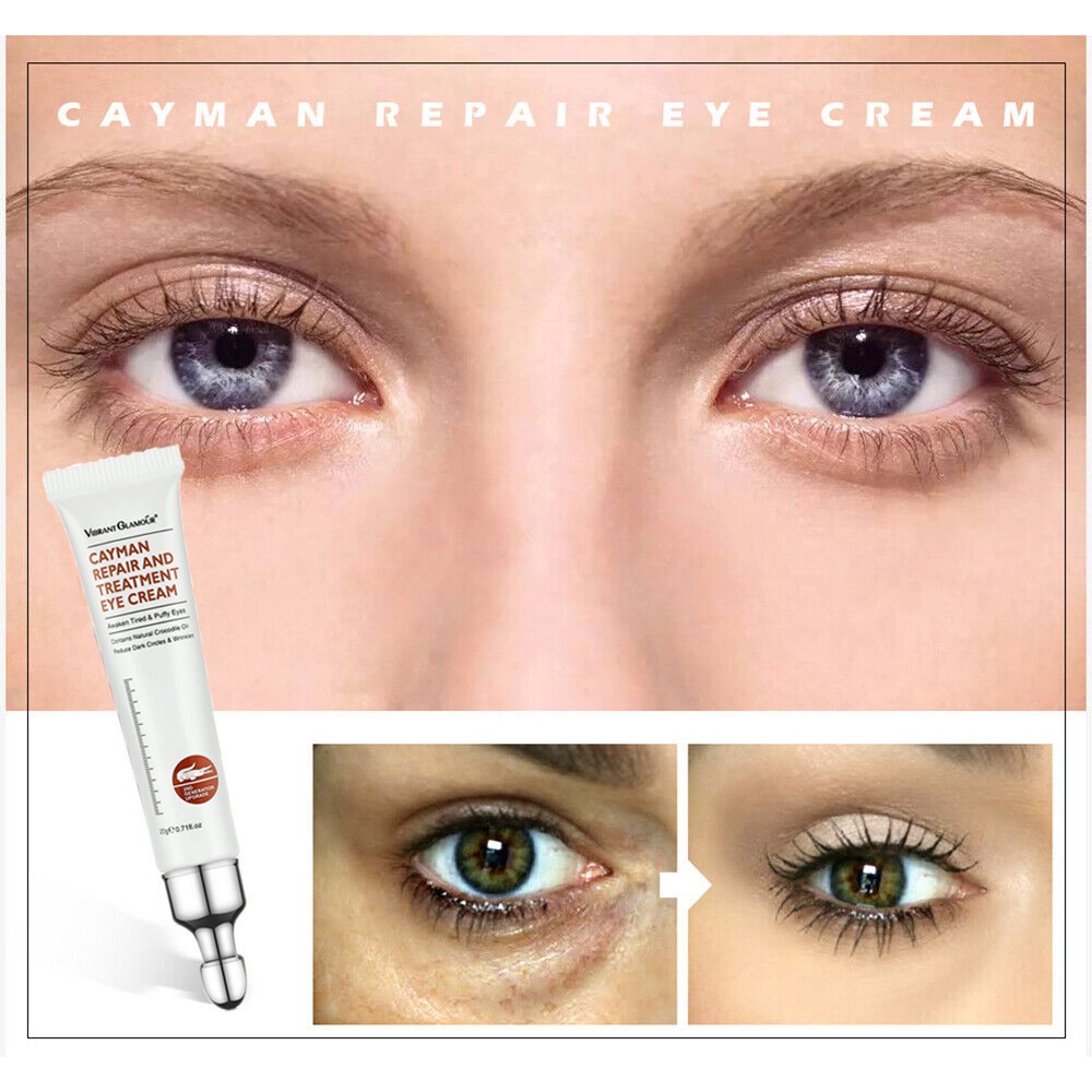 Eye Cream Instant Remove Eye Bags Dark Circles Anti Wrinkle Depuffing Firming