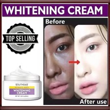 Whitening Freckle Cream for Dark Spots, Melasma  Pigmentation, 50ml