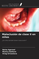Naina Agarwal (U. A.) | MaloclusióN De Clase II En NiñOs | Taschenbuch (2021)