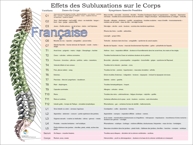Effects Symptoms Vertebral Spinal Subluxation Poster 18 X 24 