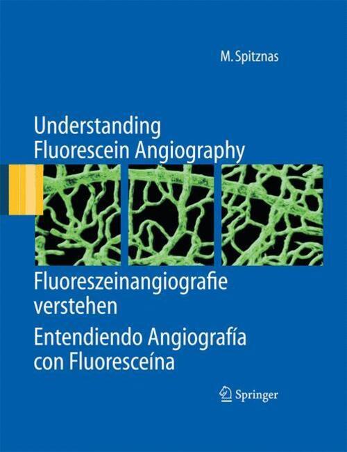 Thumbnail - Understanding Fluorescein Angiography, Fluoreszeinangiografie