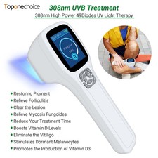 308nm UVB Phototherapy Device Medical Grade Skin Therapy Portable for Home Use