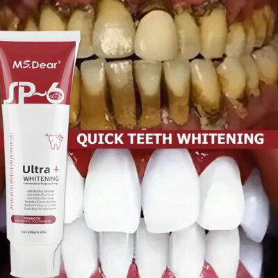 8X Sp 6 Probiotic Toothpaste Sp-6 Ultra Whitening Toothpaste Bad Breath Removing