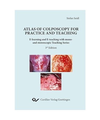Atlas of Colposcopy for Practice and Teaching: E-learning and E-teaching with mo