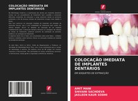 Amit Mani (U. A.) | ColocaÇÃO Imediata De Implantes DentÁRios | Taschenbuch