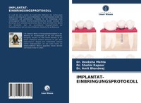 Deeksha Mehta (U. A.) | IMPLANTAT-EINBRINGUNGSPROTOKOLL | Taschenbuch | Deutsch