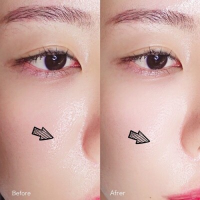 [Entity] 10 Seconds Lifting Spot Cream 1.5(oz) 30g korea /K-Beauty