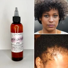 Hair Growth Oil
