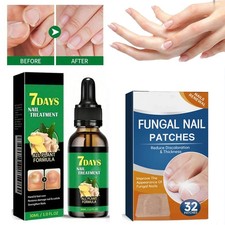 7days Toenail Fungus Ginger Treatment Nail Repair Oil Fungal Nail Repair Patches