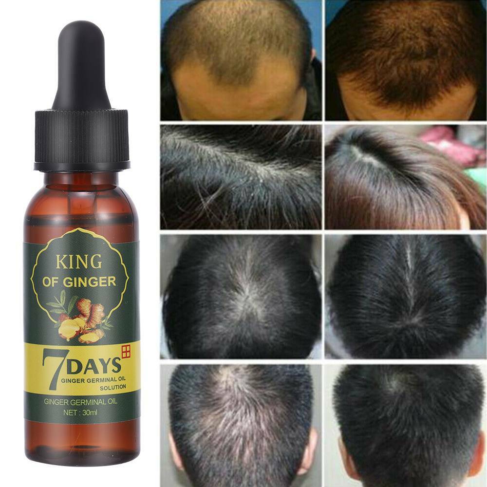 7 Days Hair Growth Products Men Women Natural Oil Serum Grow Fast Treatment  30ml | eBay