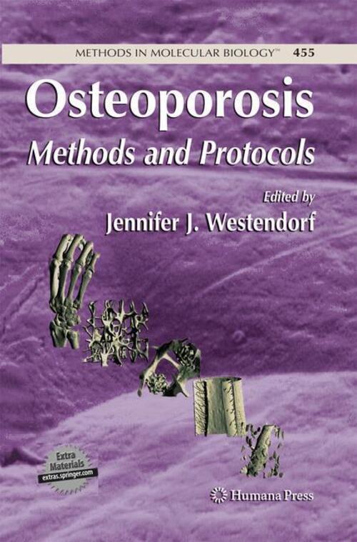 Thumbnail - Osteoporosis Methods And Protocols Jennifer Westendorf Taschenbuch