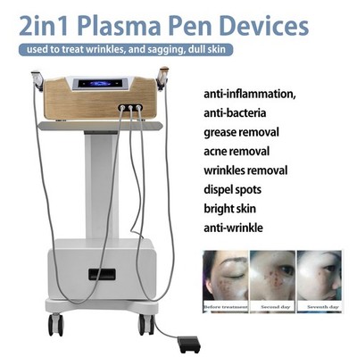 2IN1 Ozone Cold Plasma Pen Face Lifting Spot Mole Removal Acne Treatment Machine