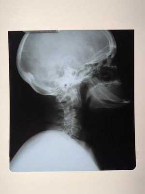 Vintage Xray Film, Medical Oddity, Skull-Skeleton-Spine-Bones, Exact Image 10x11