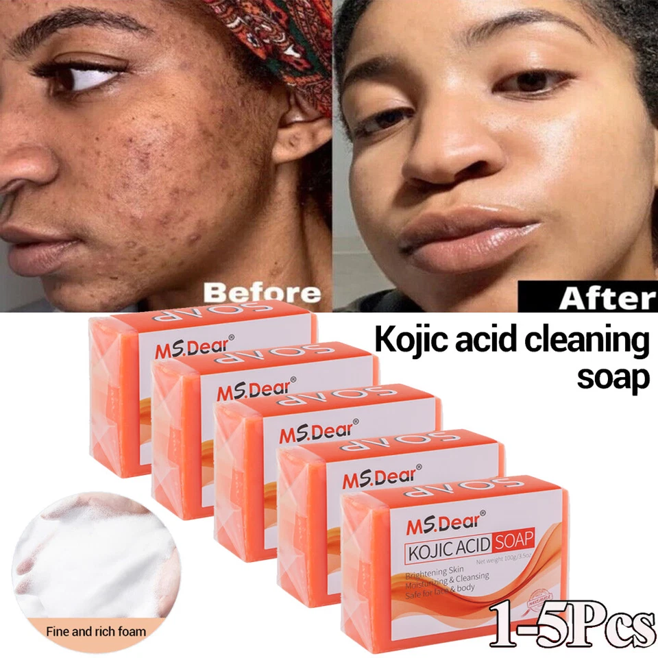 MS.DEAR Kojic Acid Soap Dark Skin Whitening Bleaching Lightening Brightening Face & Body