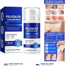Acne cream salicylic acid 1 multi-acid complex face body folliculitis pimple