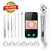 Eliminar las Espinillas Aspirador Para sacar Puntos Negros Removedor De Acne NEW