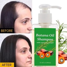 300ML Batana Oil Batana Shampoo, Rosemary Oil Shampoo, Shampoo De Batana
