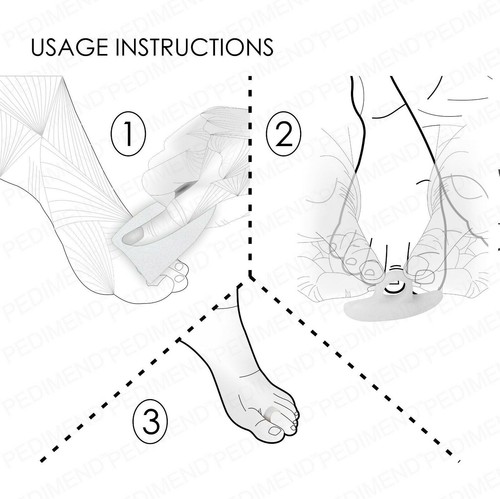 PEDIMEND Gel Toe Corrector, Hammer Toe / Claw Toe Straightener Hallux Valgus Gel - Picture 3 of 15