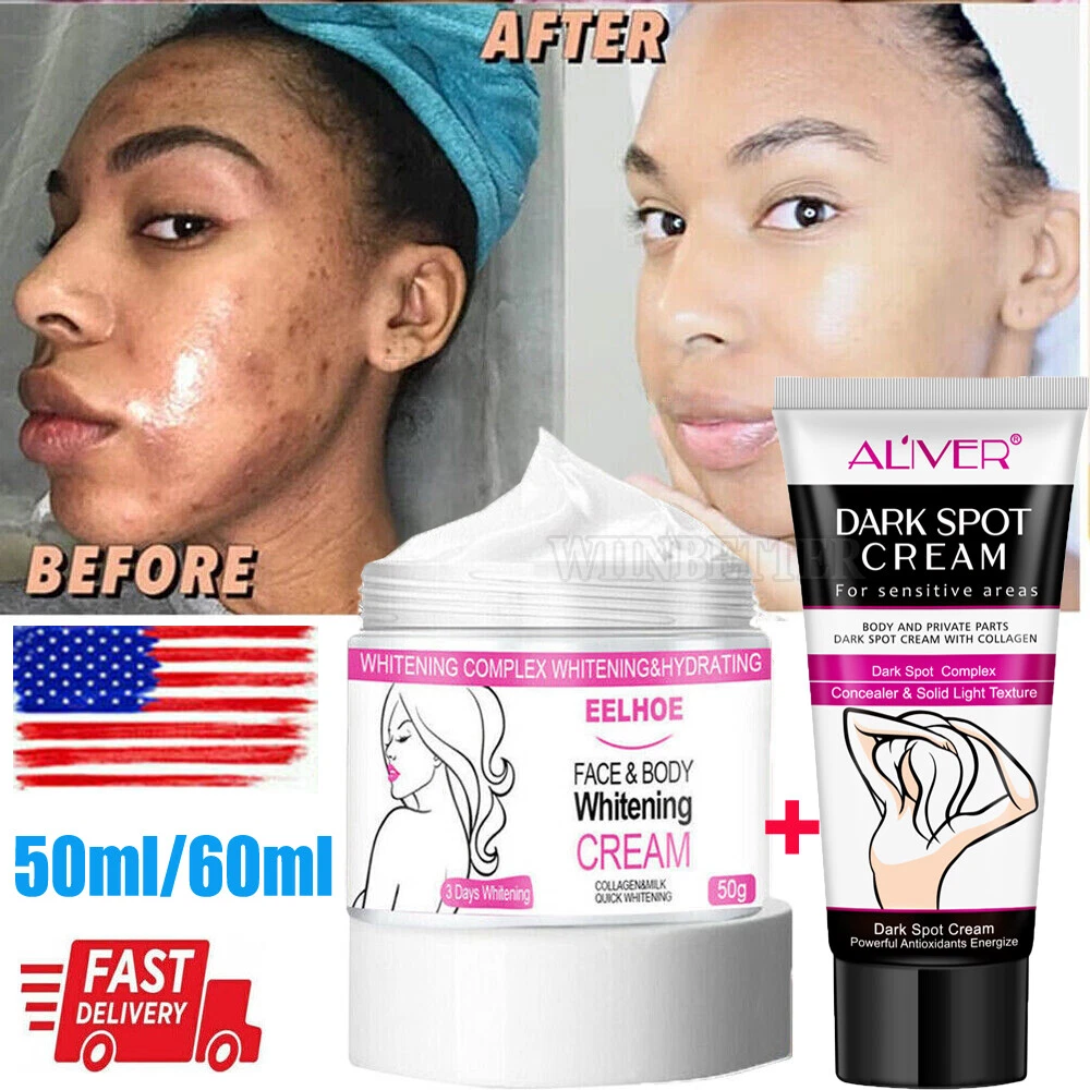 Best bleaching on sale cream for face