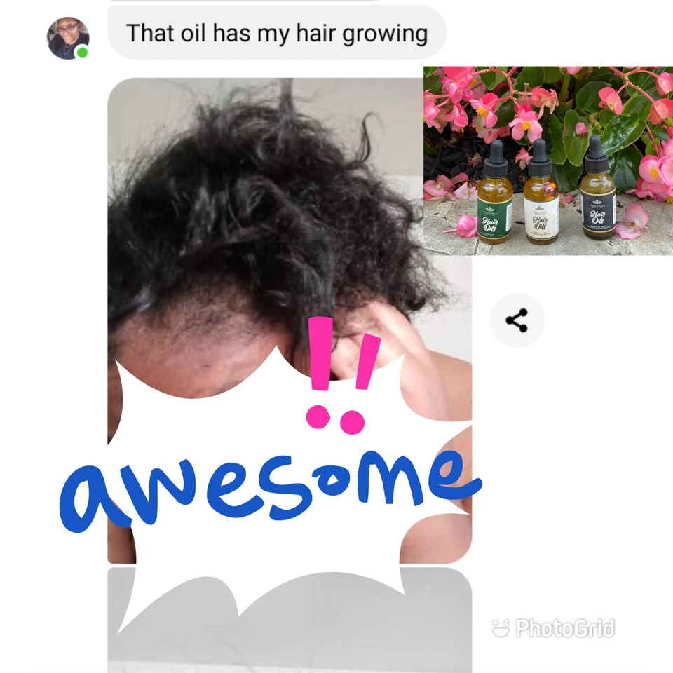 ChEBE BALD SPOT&HAIR THICKENER/100%NATURAL HAIR OIL/MEN,WOMEN &CHILDREN - Image 4 of 4