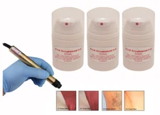 New Hair Removal Kit Post Treatment 150ml Gel- Laser IPL Machines Systems.