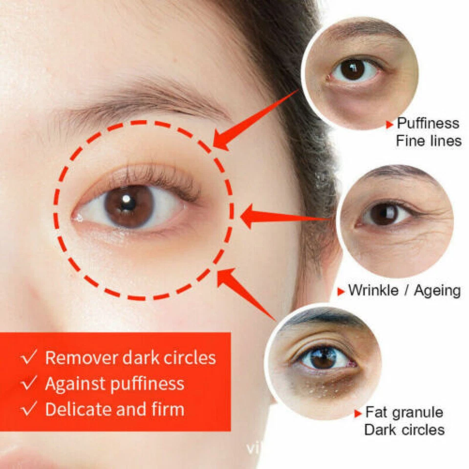 3x Eye Cream Instant Remove Eye Bags Dark Circles Anti Wrinkle Depuffing Firming - Image 3 of 4