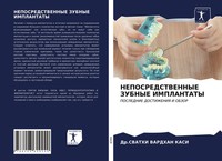 Svathi Vardhan Kasi | Neposredstvennye Zubnye Implantaty | Taschenbuch (2021)