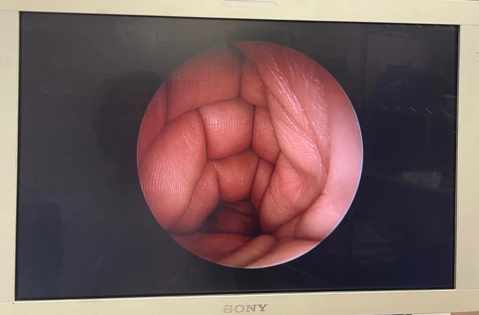 Artroscopio autoclavable Arthrex AR-3350-4070 4mm x 70º x 156mm HD Synergy Foto 2 de 4