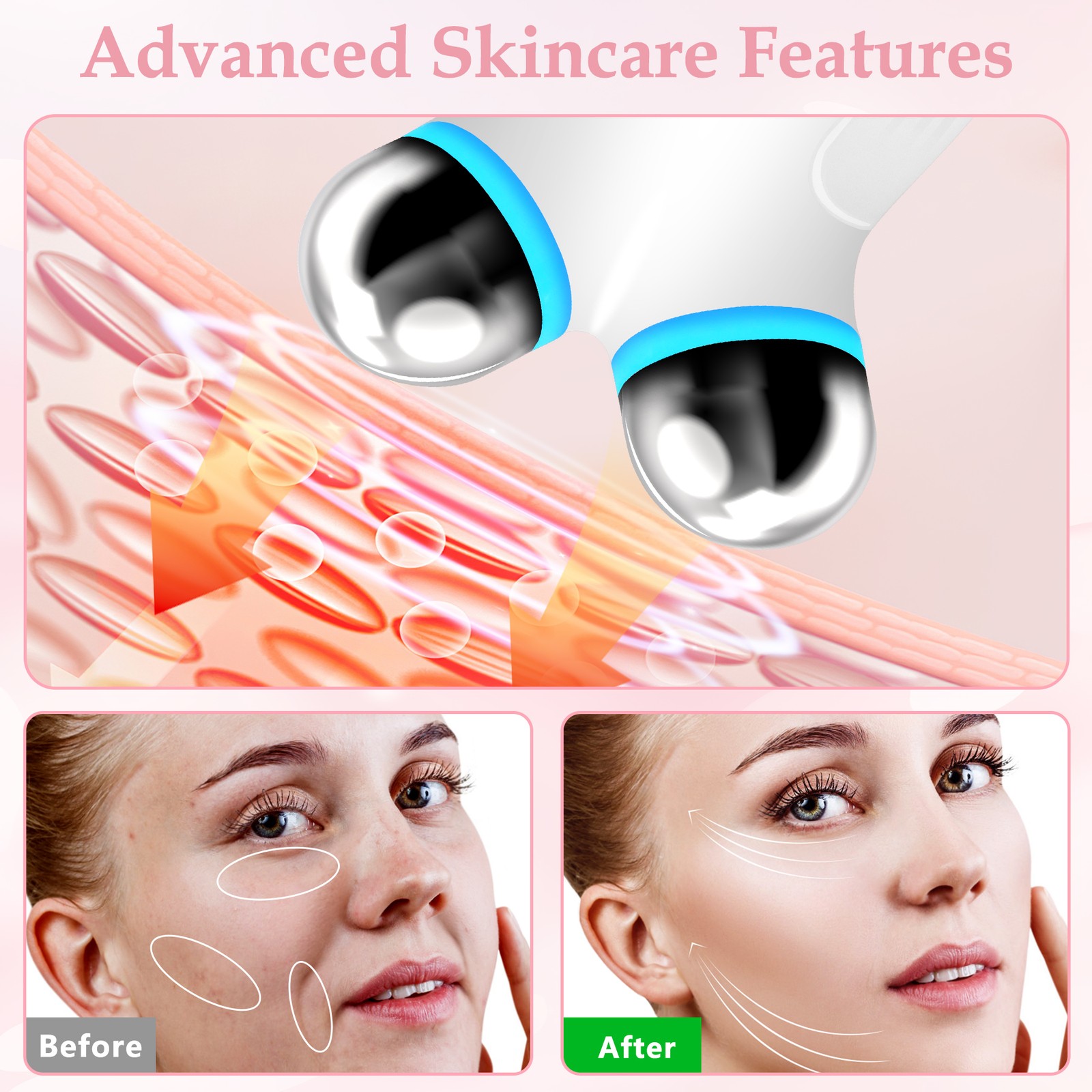 Microcurrent Facial Device for Anti-Aging & Wrinkle Reduction - Enhance Skincare alternate view 6