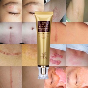 cream to remove red spots from face