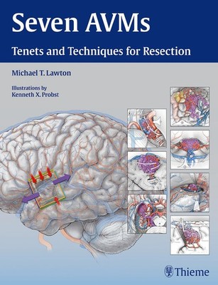 SEVEN AVMS: TENETS AND TECHNIQUES FOR RESECTION HARDCOVER **NEW**
