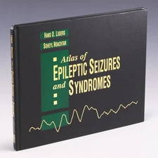 Atlas of Epileptic Seizures and Syndromes by Hans O. Luders & Soheyl Noachtar 
