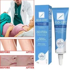 15g Silikongel zur Behandlung von alten und neuen Narben?Scar Treatment UK NEW