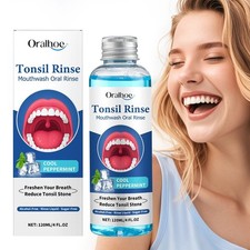 Natural Tonsil Rinse Mouthwash 120ml Tonsil Stone Remover & Bad Breath Treatment