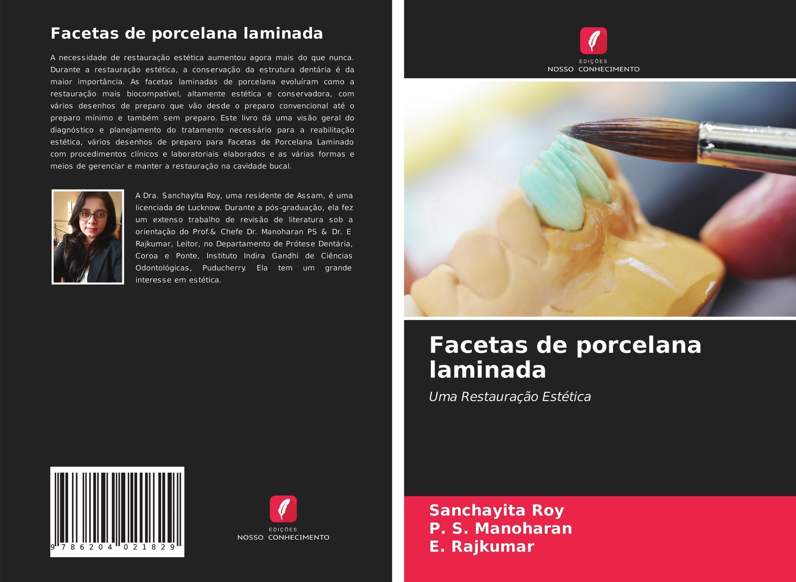 Thumbnail - Facetas De Porcelana Laminada Uma Restauração Estética Sanchayita Roy