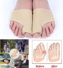 1 Pair Big Toe Bunion Corrector Splint Straightener Hallux Valgus Pain Relief US