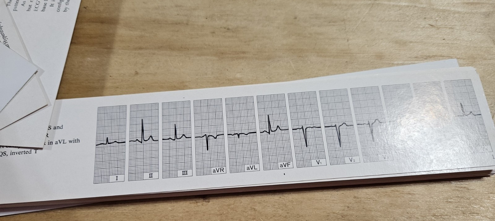 Vintage MERCK SHARP &DOHME THE ELECTROCARDIO GUIDE REPRESENTATIVE ECG CONDITIONS
