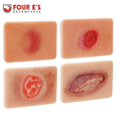 #ad Decubitus Ulcer Wound Model Bedsores Model Pressure Injury Model Stages I–IV $129.99