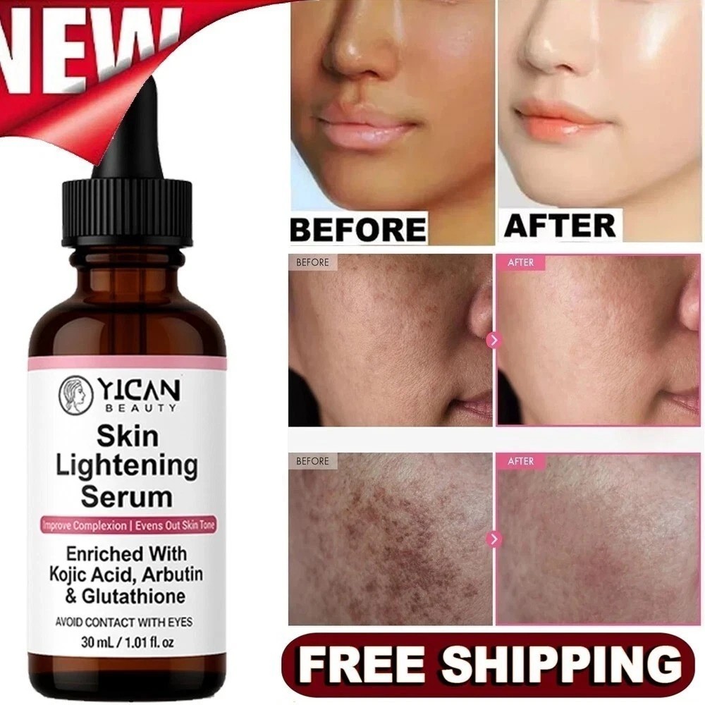 Skin Whitening Serum - Lighten Body Blemishes, Brighten Skin Tone, Protect Skin