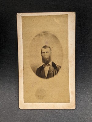 Unidentified Man CDV Photograph 