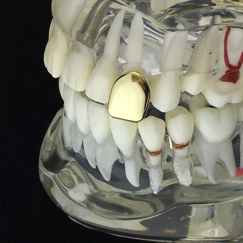 Gorra dental enchapada en oro de 14 K plata esterlina 925 sólida un solo diente Grillz - Imagen 2 de 9