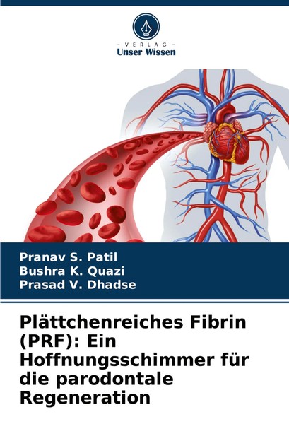 PläTtchenreiches Fibrin (Prf): Ein Hoffnungsschimmer FüR Die Parodontale...-image