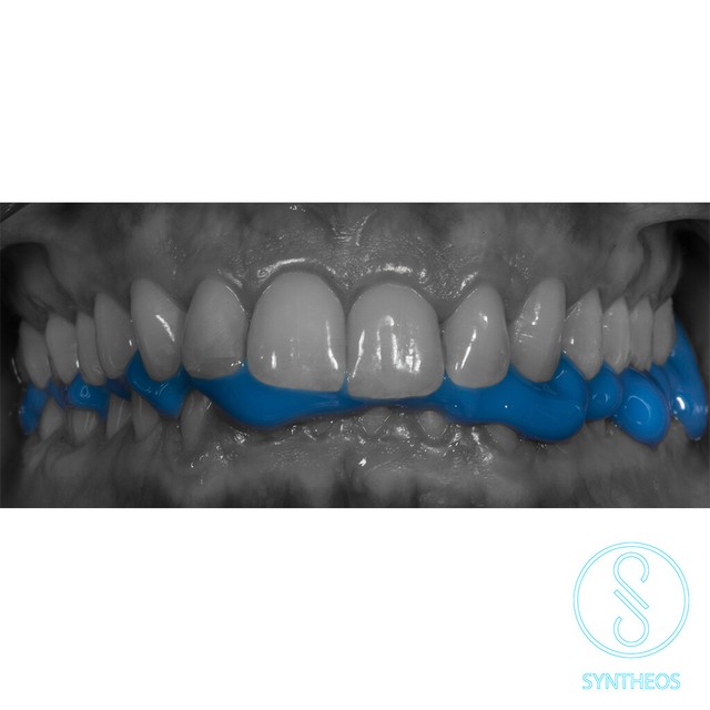 Synbite Plus Bis Acrylic Bite Registration Material 50ml Impression