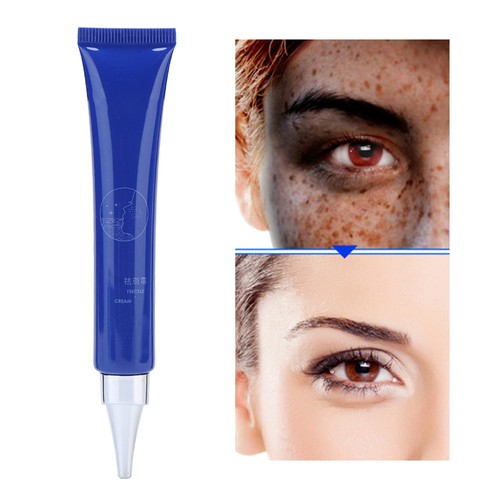 20g Face Freckle Removal Cream Lightening Age Spots Freckles Whitening Facia BBY - Picture 4 of 11