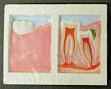 vintage #4 McKesson Robbins DISPLAY TOOTH Dentist study aid dental dentistry z5