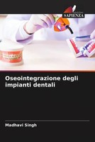 Madhavi Singh | Oseointegrazione Degli Impianti Dentali | Taschenbuch (2023)