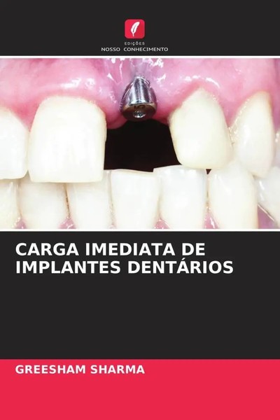 Greesham Sharma | Carga Imediata De Implantes DentÁRios | Taschenbuch (2022)-image