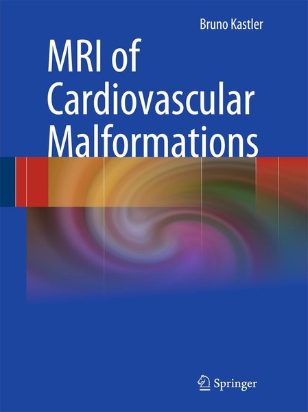 MRI Of Cardiovascular Malformations Bruno Kastler-image