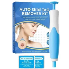 Auto Skin Tag Removal Tool Kit Painless Skin Label Mole Acne Wart Removal Pen